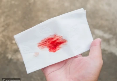 متى يصبح السعال الدموي ناقوس خطر؟
