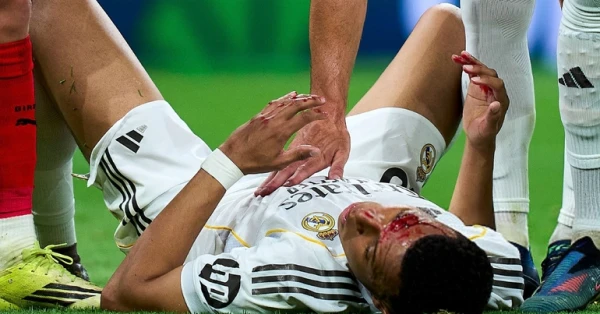 إصابة مبابي تثير الجدل في مباراة ريال مدريد وجيرونا