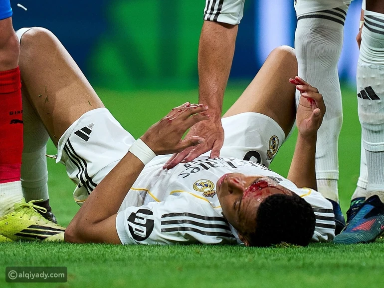 إصابة مبابي تثير الجدل في مباراة ريال مدريد وجيرونا