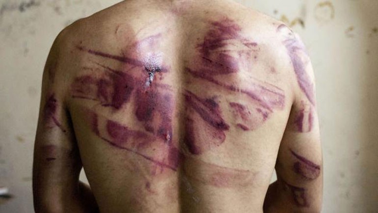 سجن متهمان اتهما شخص بأنه "مُخبر للشرطة" واعتدوا عليه بالضرب