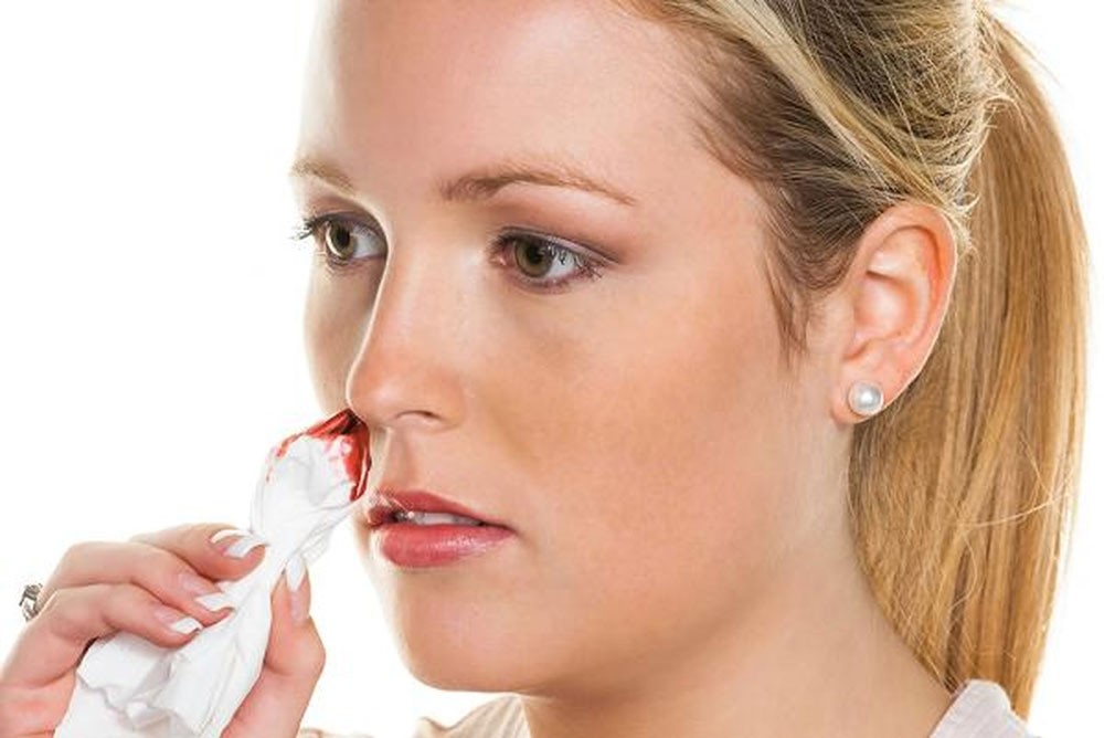 اسباب نزيف الانف وكيفية علاجه