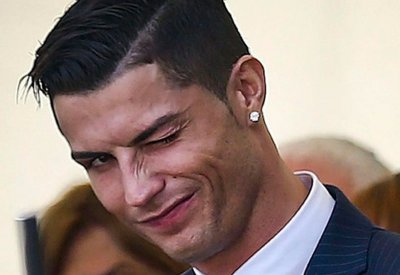 بعد تعافيه من إصابة الوجه.. رونالدو : ما زلت وسيما