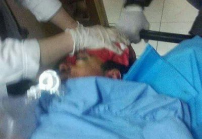 وزارة الصحة الفلسطينية تعلن عن استشهاد فتى "16 عام"