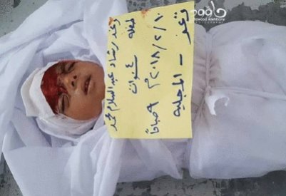 تعز.. مجزرة حوثية جديدة وتقدم ميداني للجيش