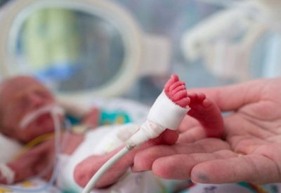اكتشاف جديد لحماية الأطفال الخدّج من الإصابة بالعمى