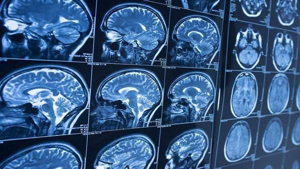 "أدمغة الأطفال" تنقذ البالغين البكم