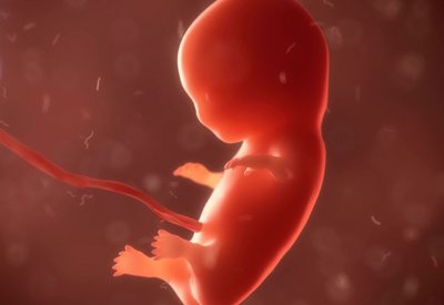 مشاكل الخصوبة تزيد من مخاطر ولادة طفل مبتسر أو يعاني تشوهات خلقية