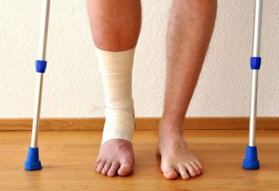 7 أطعمة تساعد عظامك المكسورة على الالتئام.. فما هي؟