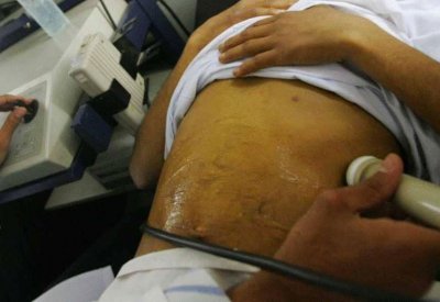 أمل جديد لمرضى تليف الكبد.. كشف قد يغني عن الزراعة