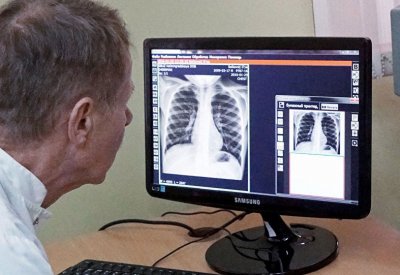 دراسة حديثة تربط بين الربو واضطراب نقص الانتباه مع فرط النشاط