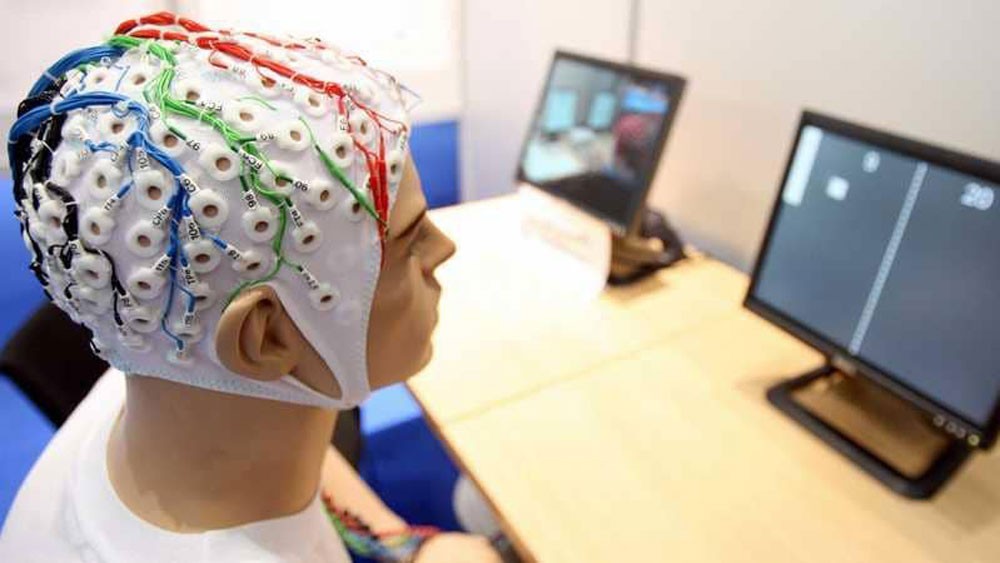 اكتشاف خلية "فريدة" بالمخ تميز الإنسان عن باقي الكائنات