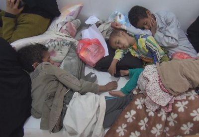 الأمم المتحدة: اليمن يشهد أسوأ انتشار لوباء الكوليرا