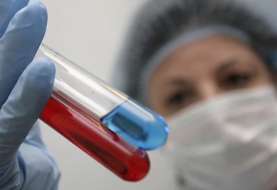 نتائج مبشرة لعلاج فيروس الإيدز