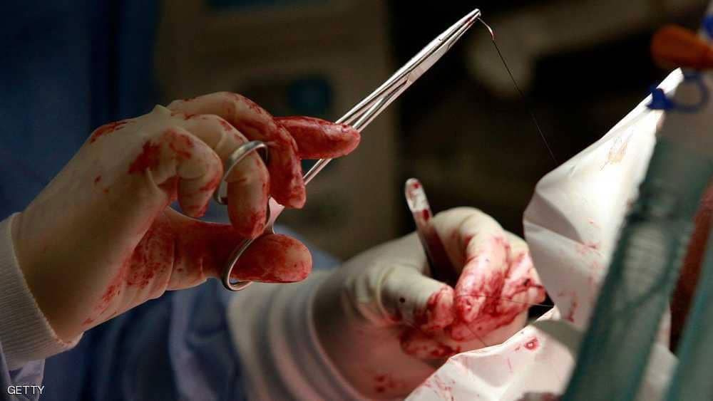  "دراسة ثورية" تجد بديلا ممكنا لعملية الزائدة الدودية