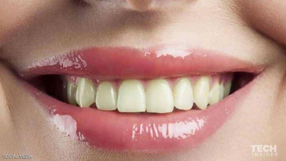  "تبييض الأسنان" خدعة هائلة.. والحل بسيط جدا
