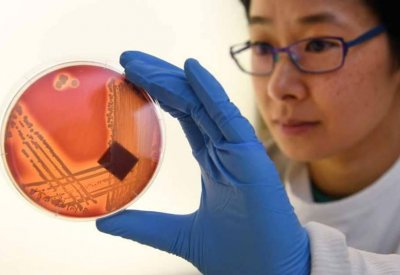مقاومة المضادات الحيوية.. خطر ينذر بقتل الملايين في 2050