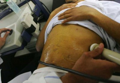  أعراض قد تكون مؤشرا على الإصابة بسرطان الكبد