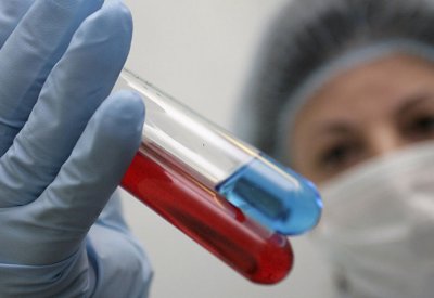 باحثون مصريون يبتكرون عقارا جديدا يقضي على السرطان