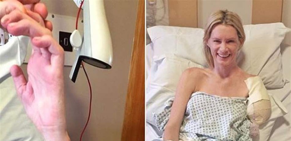 ممثّلة تفقدُ يدها في مشهدٍ خطير.. والتعويض 2.7 مليون دولار!