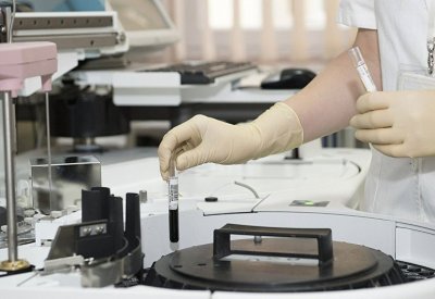 رجل يتحول دمه إلى حليب