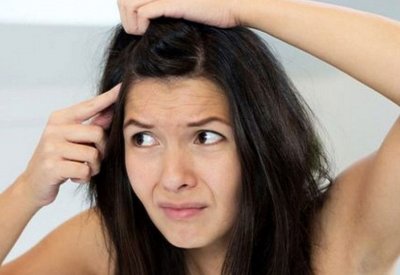 دراسة: قشرة الرأس ترتبط بمرض خطير