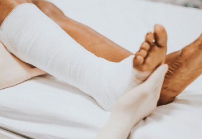 تقنية جديدة للتخلص من تجلطات الساق