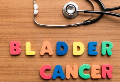 أميركا توافق على عقار جديد لعلاج سرطان المثانة
