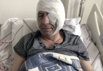 تورط أنصار أردوغان في هجوم على صحافي بالهراوات