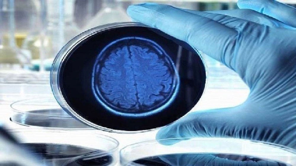 اكتشاف جديد يعطي أملا لعلاج الأعراض المبكرة لمرض ألزهايمر
