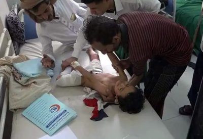 مجزرة حوثية جديدة ضد أطفال تعز