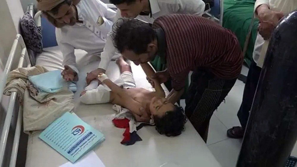 مجزرة حوثية جديدة ضد أطفال تعز