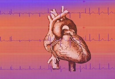 خفقان القلب وأسبابه