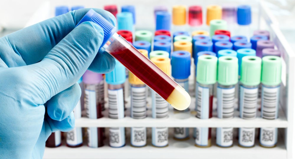 صناعة الدم في اليابان تحدث ثورة في الوسط الطبي