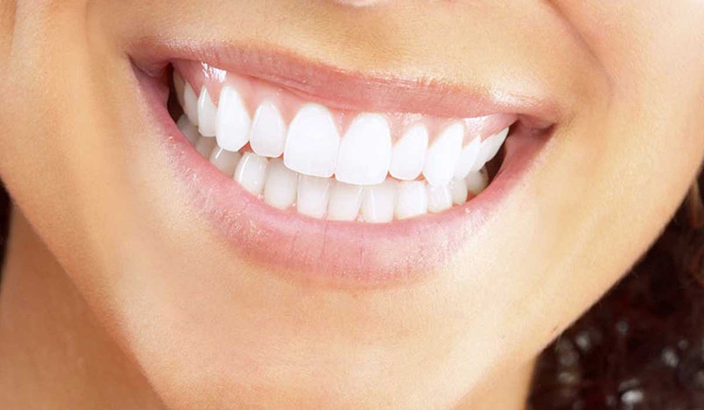 أهم الأسئلة الشائعة عن زراعة الأسنان وأجوبتها