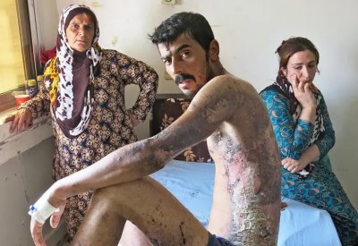 بريطانيا تطالب بتحقيق أممي حول استخدام تركيا للفوسفور الأبيض ضد الأكراد