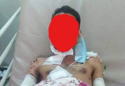 ألغام الحوثي تحصد 484 مدنياً في تعز