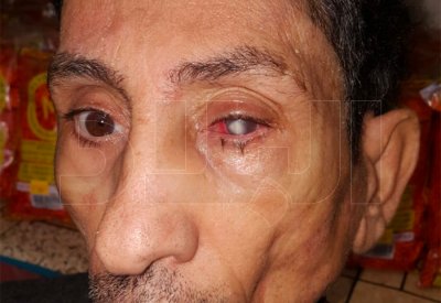 بالصور: قطور من "السلمانية" يعمي العيون.. وثابت لـ "البلاد": فقدت 90% من بصري