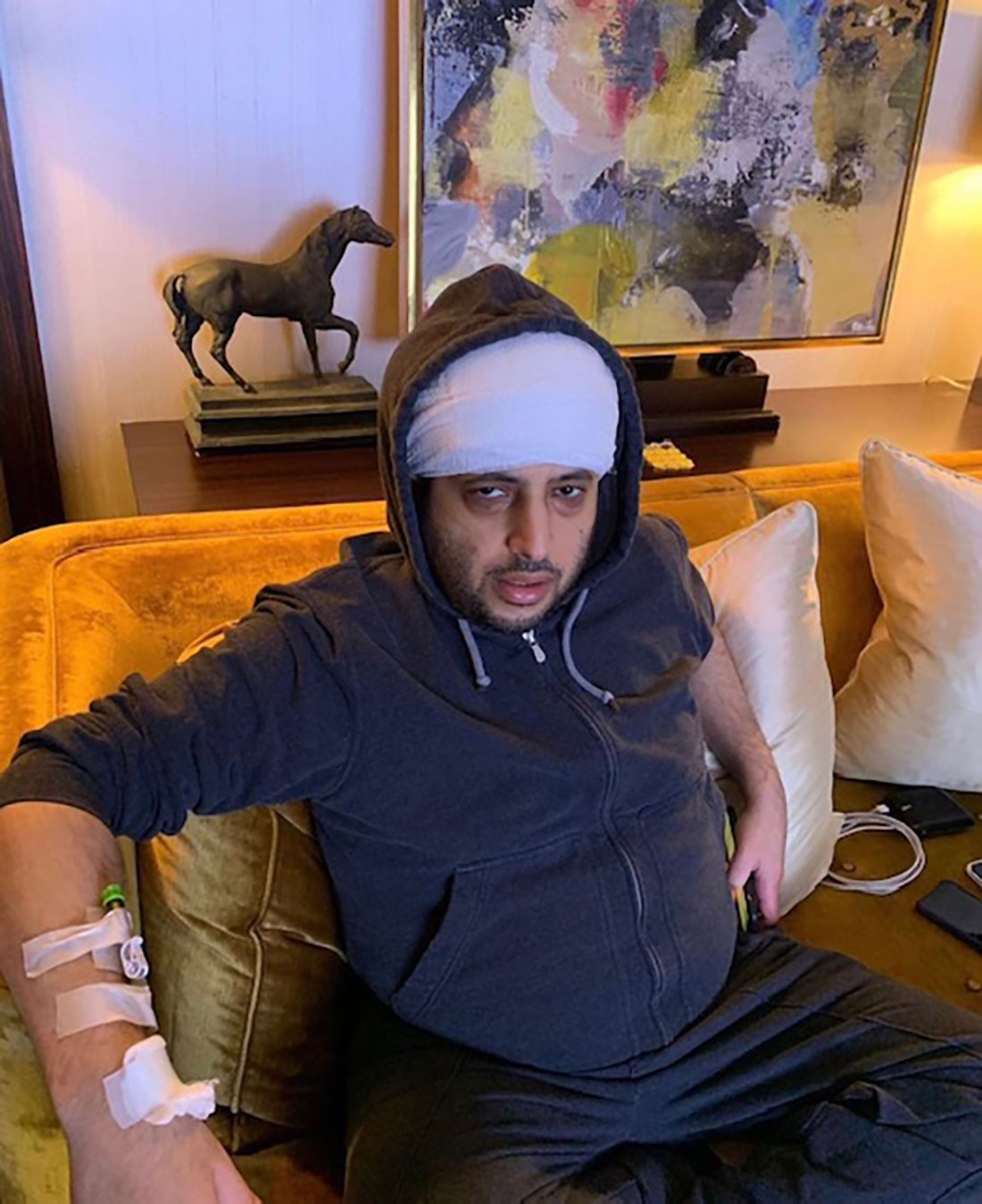 أحدث صورة لتركي آل الشيخ بعد عملية الرأس.. ونانسي عجرم: "الله يحميك لعيلتك وأهلك ومحبينك"
