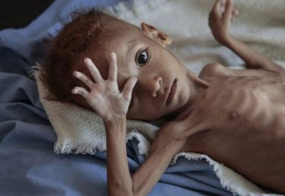 الأمم المتحدة: الحوثيون عرقلوا تدفق نصف المساعدات لليمن