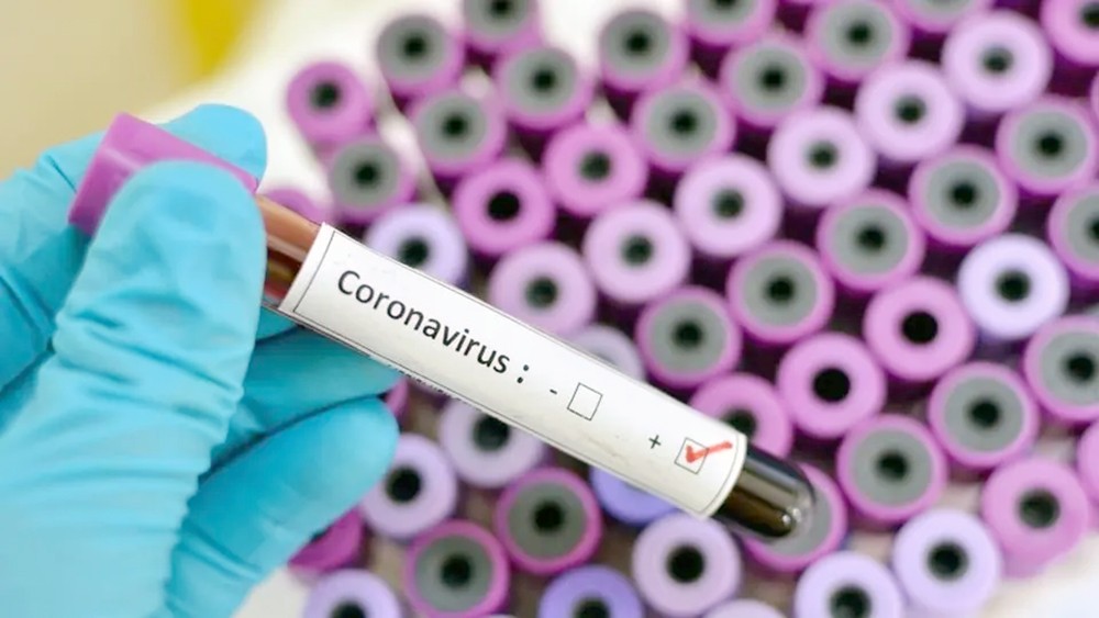 أمل جديد.. إنتاج أول لقاح صيني محتمل لعلاج كورونا