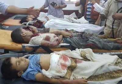 حصيلة ثقيلة لضحايا صواريخ الحوثي من المدنيين في مأرب