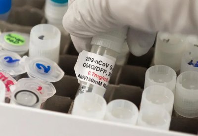 مستثمرون يكسبون 7 مليارات دولار من لقاح كورونا.. كيف؟