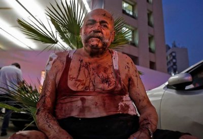 مشاهد مروعة من مستشفى لبناني للعشرات من جرحى انفجار بيروت