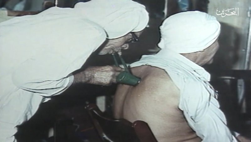 رجال ونساء المحرق عرفوا بمهارتهم في مجال الطب الشعبي