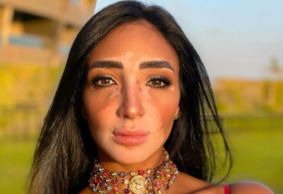 لجينة صلاح التي غيرت مقاييس الجمال
