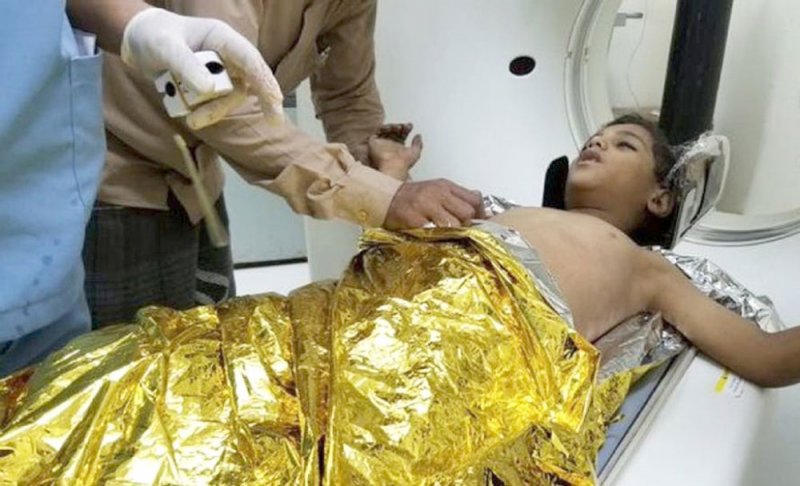 مجزرة حوثية تحصد أطفالا في تعز