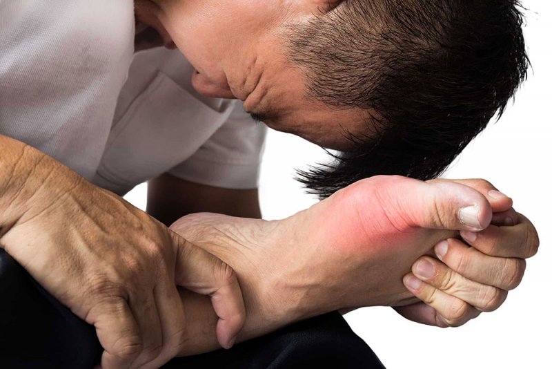 النظام الصحي الغذائي لمرضى النقرس