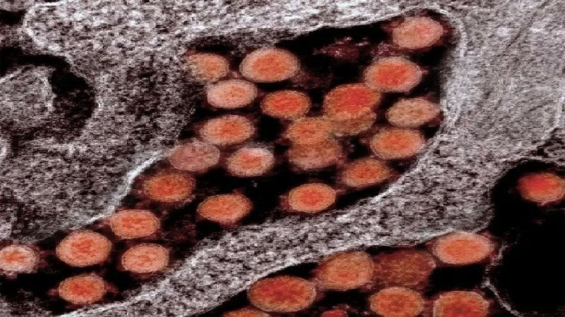 كيف يدخل؟.. دراسة تفتح باب الأمل لمحاصرة كورونا