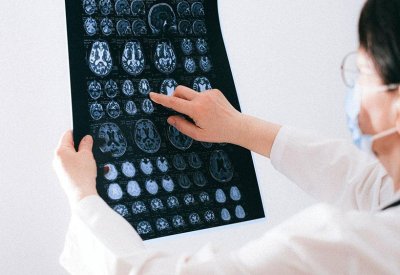 ماذا تعرف عن "المادة البيضاء" في الدماغ؟