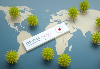 إصابات كورونا تتخطى 80 مليون حالة عالمياً